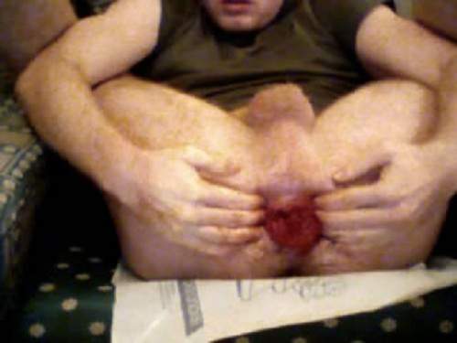 Webcam man bloody fisting anal and rosebutt ass