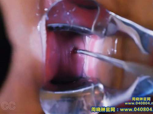 Amateur fisting – Chinese Zhou Xiaolin speculum and urethral sounding