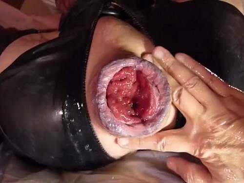 Deep fisting – Gays extremely anal prolapse porn during fisting sex homemade POV