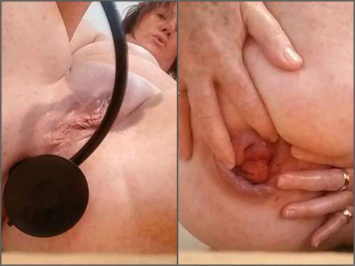 Webcam – Big ass girl penetration inflatable dildo in her prolapse asshole