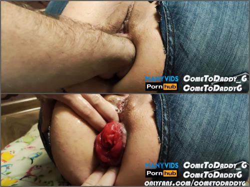 Prolapse ass – ComeToDaddy_G tore my jeans with my ass gape, prolapse anal amateur