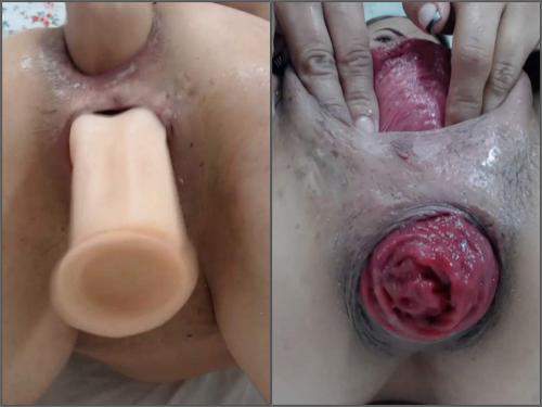 Cervix stretching – Carolinauribe again anal prolapse and pussy ruined