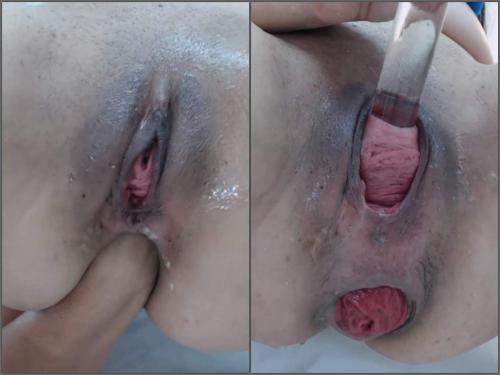 Pussy fisting – Webcam latina Carolinauribe cervix stretching and loose prolapse anal hardcore