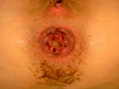 Shitting ass – Young teen shitting anal rosebutt and gape loose closeup