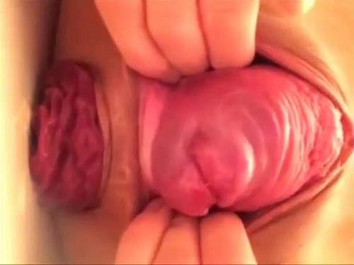 Cervix – Amateur Japanese girl again stretching her huge prolapse and monster cervix