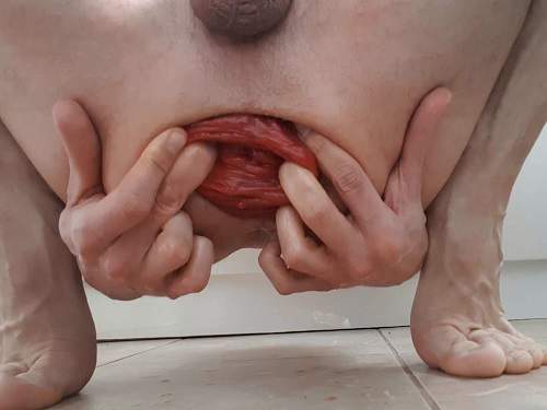 Closeup – Amateur male hardcore stretching his giant anal prolapse