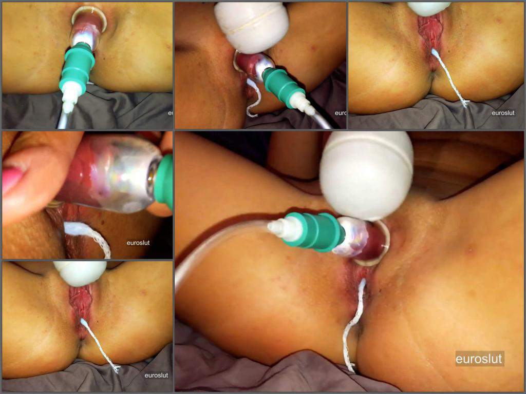 Pussypump - Euroslut large labia and clit pump in bloody period.