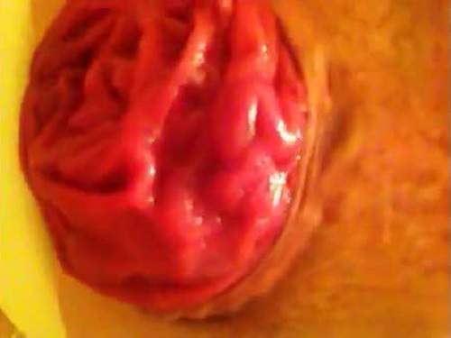 Closeup – Really amateur closeup monster size prolapse anal