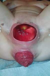 Prolapse ass – Anus prolapse very close kinky mature with piercing labia