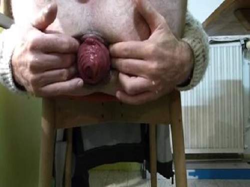 Anal prolapse – Anus prolapse fantastic sized hot male webcam