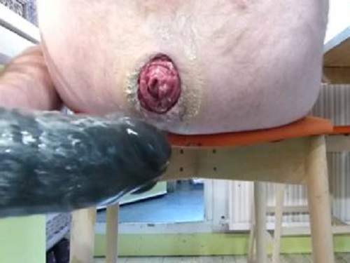 Male anal – Crazy man destroyed his colossal ass prolapse