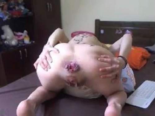 Anal insertion – Bald tattooed girl ruined her anal rosebutt