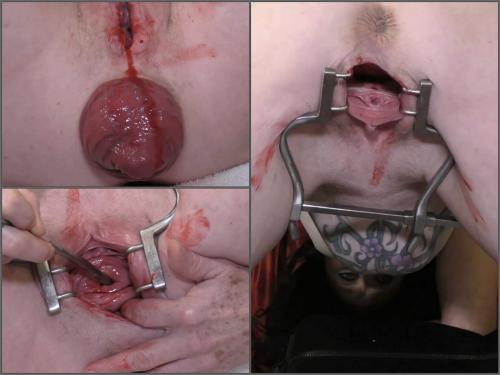 Prolapse porn – Bloody period speculum examination with dirty brunette