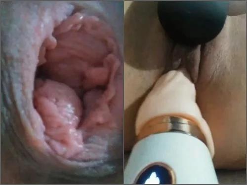 Prolapse – Large labia wife very close-up show pucker anal and dildos penetration