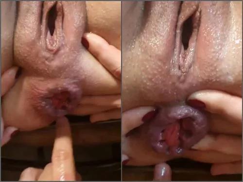 Closeup – Fisting_squirt First prolapse of my ass Anal fisting that makes me squirt