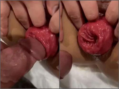 Prolapse porn – Brunette Aydyr Multiple squirting session having my prolapsed ass fucked