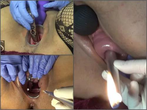 Urethra – Fantastic medical examination with huge cervix stretching from Maya Simons