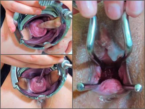 Speculum examination – Andradahot Medical Inspection inside my Cervix closeup – Premium user Request