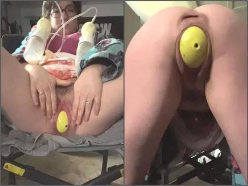 Ball penetration – Hairy fatty pornstar QueenOfStretch nipples pump during vaginal terror