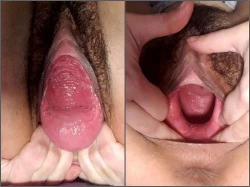Pussy prolapse – Dirty hairy teen Vixenxmoon penetration tunnel plug in pussy prolapse